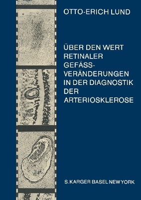 Über den Wert retinaler Gefässveränderungen in der Diagnostik der Arteriosklerose (insbesondere der Hirnarteriosklerose) - 