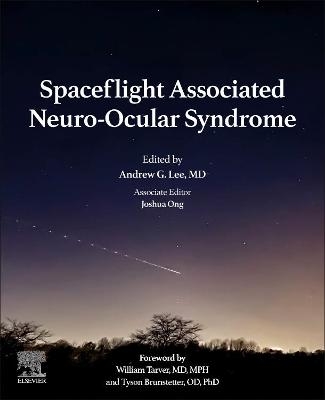 Spaceflight Associated Neuro-Ocular Syndrome - 