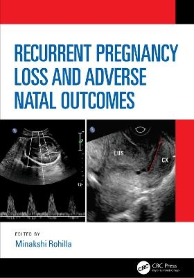 Recurrent Pregnancy Loss and Adverse Natal Outcomes - 