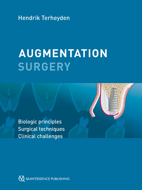 Augmentation Surgery - Hendrik Terheyden