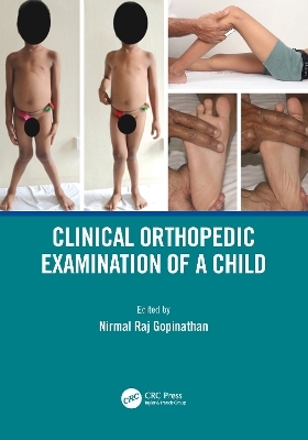 Clinical Orthopedic Examination of a Child - 