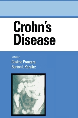 Crohn's Disease - 