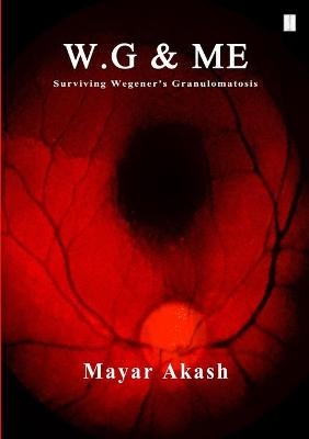 W.G & ME, Surviving Wegener's Granulomatosis - Mayar Akash