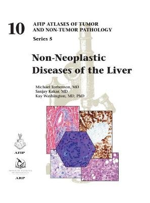 Non-Neoplastic Diseases of the Liver - Michael Torbenson, Sanjay Kakar, Kay Washington