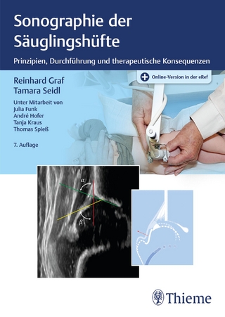 Sonographie der Säuglingshüfte - Reinhard Graf; Tamara Seidl