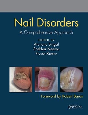 Nail Disorders - 