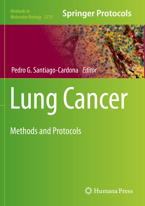 Lung Cancer - 