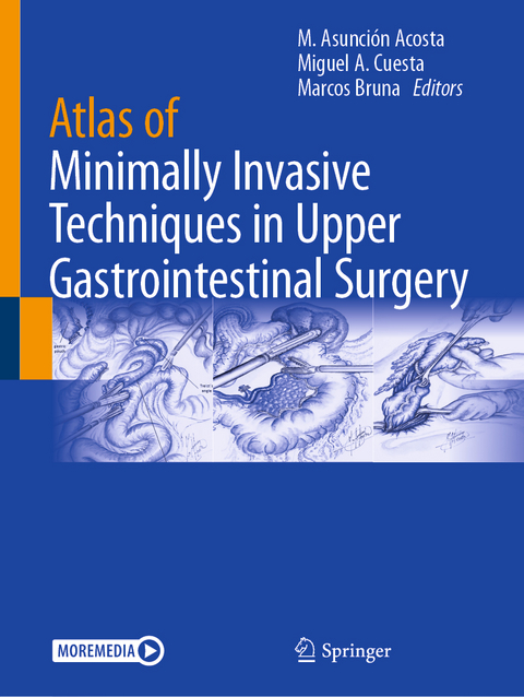 Atlas of Minimally Invasive Techniques in Upper Gastrointestinal Surgery - 