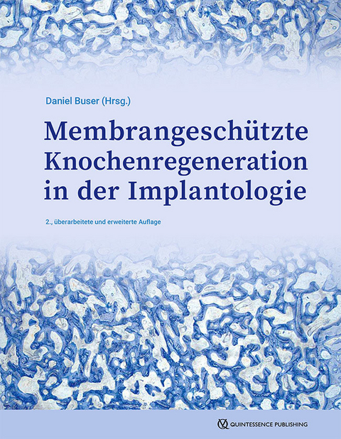 Membrangeschützte Knochenregeneration in der Implantologie - 