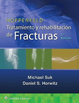 Hoppenfeld. Tratamiento y rehabilitación de fracturas - Michael Suk, Daniel S. Horwitz