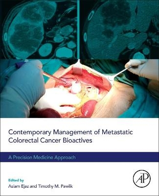 Contemporary Management of Metastatic Colorectal Cancer - 