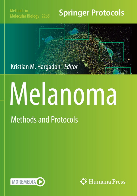 Melanoma - 