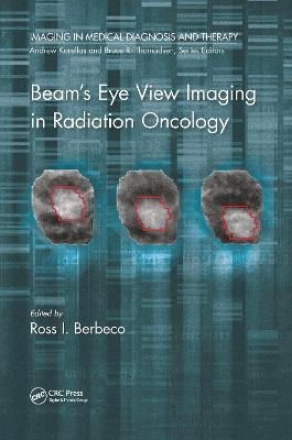 Beam's Eye View Imaging in Radiation Oncology - 