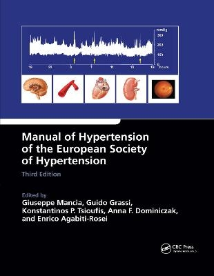 Manual of Hypertension of the European Society of Hypertension, Third Edition - 