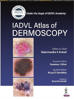 Atlas of Dermoscopy - Balachandra S Ankad, Yasmeen J Bhat, Kinjal D Rambhia