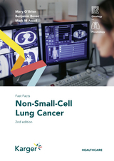 Fast Facts: Non-Small-Cell Lung Cancer - Mary O'Brien, Benjamin Besse, Mark M. Awad