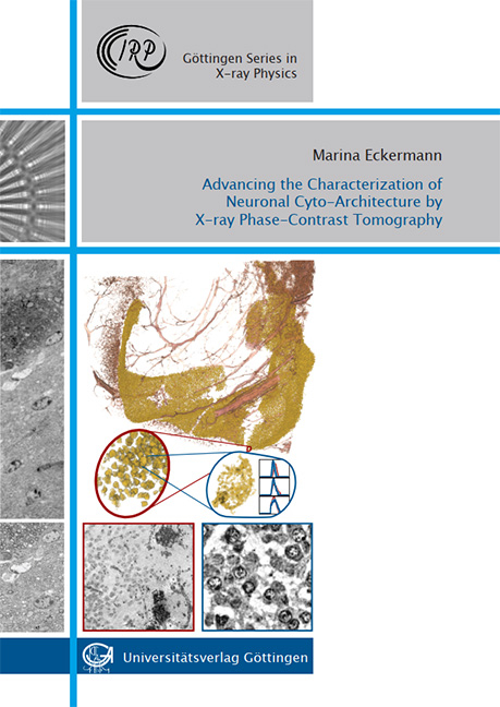 Advancing the Characterization of Neuronal Cyto-Architecture by X-ray Phase-Contrast Tomography - Marina Eckermann