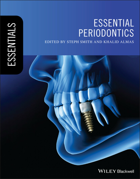 Essential Periodontics - 