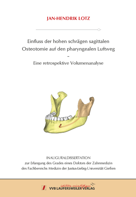 Einfluss der hohen schrägen sagittalen Osteotomie auf den pharyngealen Luftweg - Jan-Hendrik Lotz