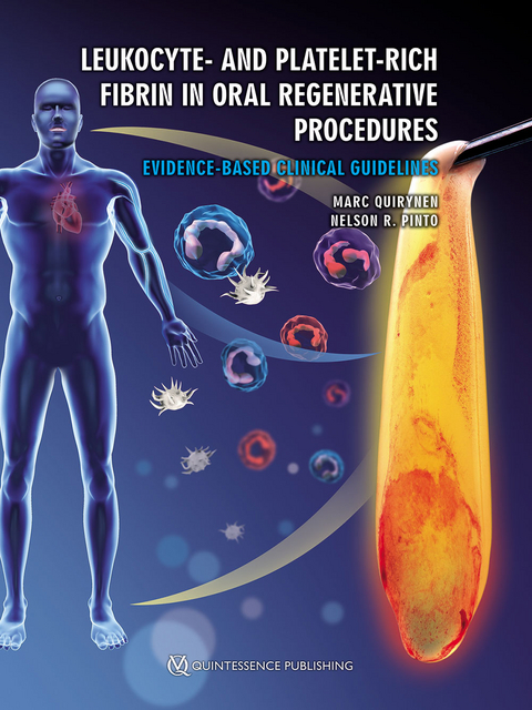 Leukocyte- and Platelet-Rich Fibrin in Oral Regenerative Procedures - Marc Quirynen, Nelson R. Pinto