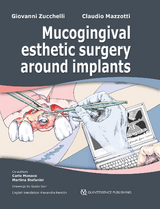 Mucogingival Esthetic Surgery around Implants - Giovanni Zucchelli, Claudio Mazzotti