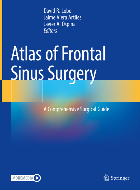 Atlas of Frontal Sinus Surgery - 