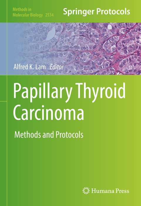 Papillary Thyroid Carcinoma - 