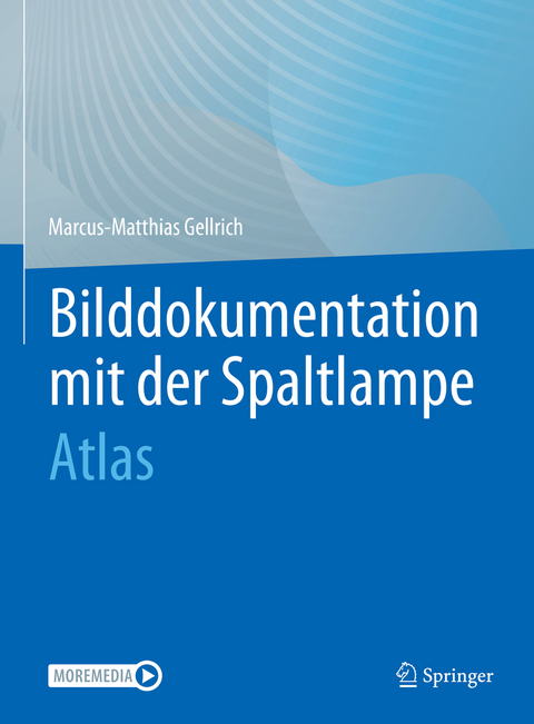 Bilddokumentation mit der Spaltlampe - Marcus-Matthias Gellrich