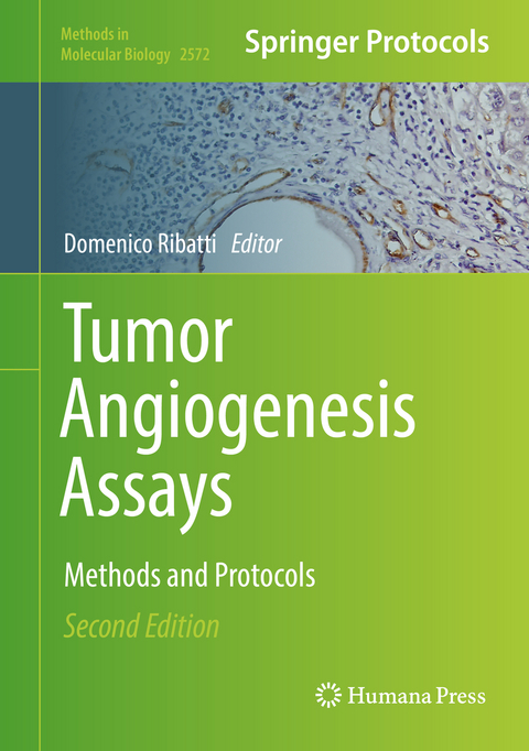 Tumor Angiogenesis Assays - 