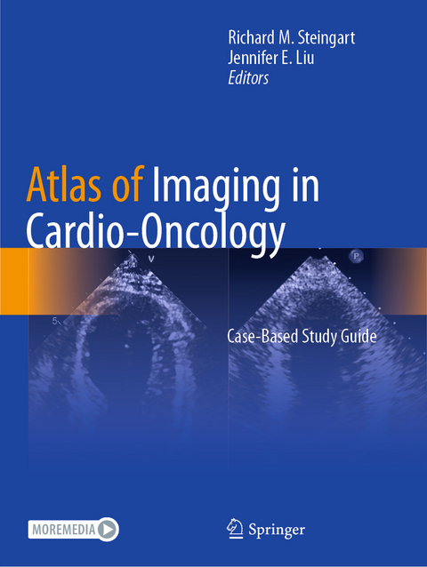 Atlas of Imaging in Cardio-Oncology - 