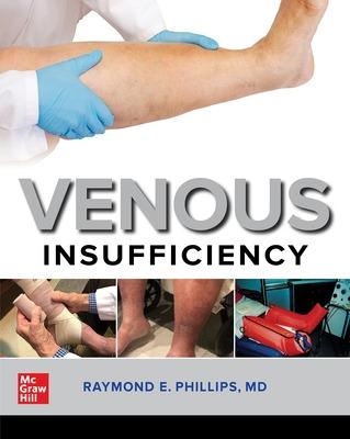 Venous Insufficiency - Raymond E. Phillips