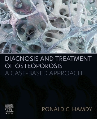 Diagnosis and Treatment of Osteoporosis - Ronald C. Hamdy