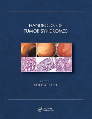 Handbook of Tumor Syndromes - 