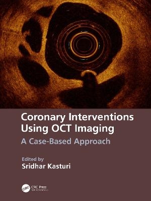 Coronary Interventions Using OCT Imaging - 