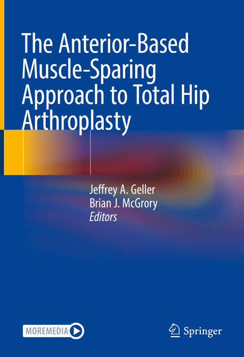 The Anterior-Based Muscle-Sparing Approach to Total Hip Arthroplasty - 