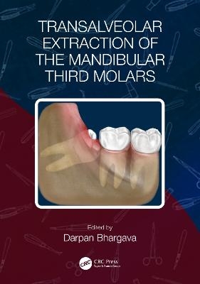 Transalveolar Extraction of the Mandibular Third Molars - 