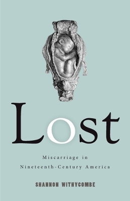 Lost - Shannon Withycombe