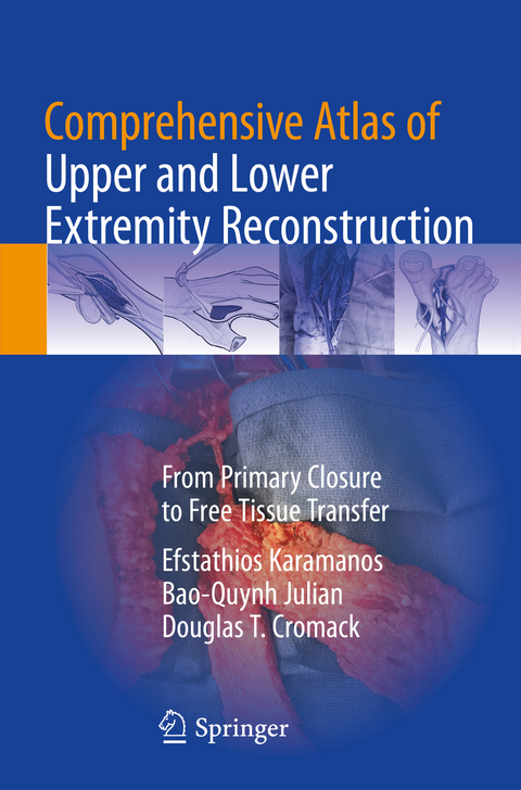 Comprehensive Atlas of Upper and Lower Extremity Reconstruction - Efstathios Karamanos, Bao-Quynh Julian, Douglas T. Cromack