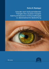 Katarakt nach bulbuserhaltender Therapie intra-okulärer maligner Aderhautmelanome mit Brachytherapie vs. stereotaktischer Bestrahlung - Rastegar, Zahra N.