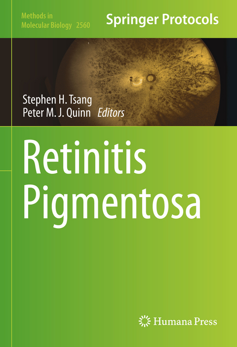 Retinitis Pigmentosa - 