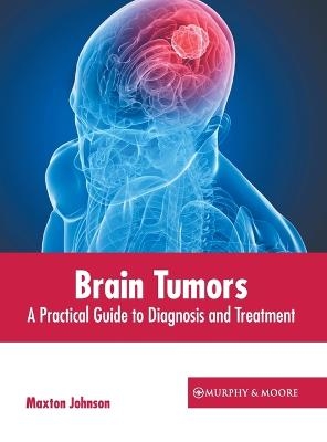 Brain Tumors: A Practical Guide to Diagnosis and Treatment - 