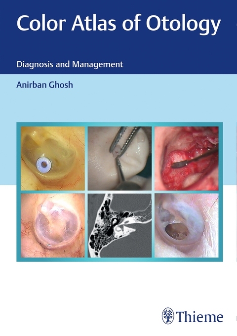 Color Atlas of Otology - Anirban Ghosh