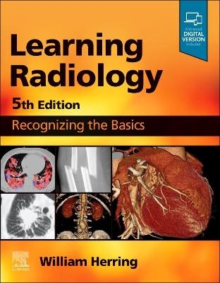 Learning Radiology - William Herring