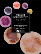 Atlas of Dermoscopy - Marghoob, Ashfaq A; Braun, Ralph; Jaimes, Natalia