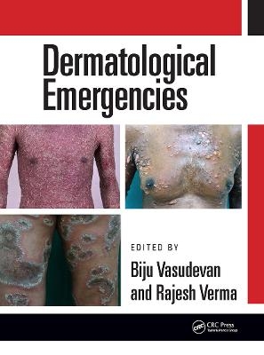 Dermatological Emergencies - 