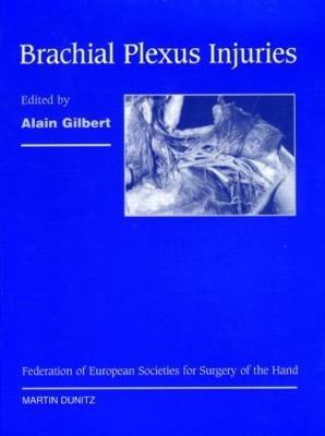 Brachial Plexus Injuries - 