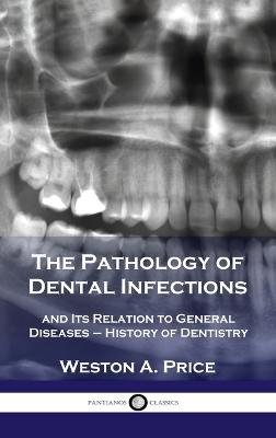 Pathology of Dental Infections - Weston A Price