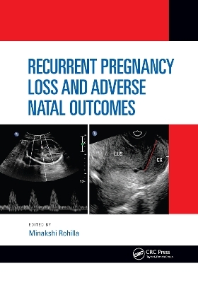 Recurrent Pregnancy Loss and Adverse Natal Outcomes - 