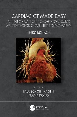 Cardiac CT Made Easy - 