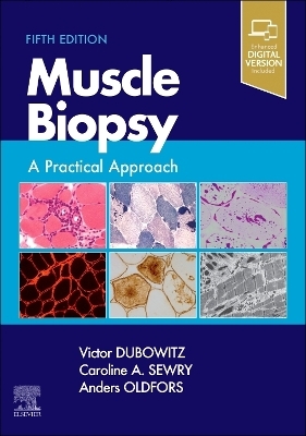 Muscle Biopsy - Victor Dubowitz, Caroline A. Sewry, Anders Oldfors